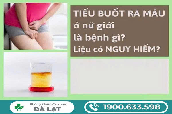 Hình ảnh minh họa